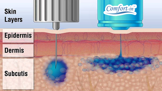 Needles vs Comfort-in needle-free insulin injection system